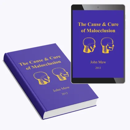 The Cause & Cure of Malocclusion by Dr. John Mew, 2013 edition — hardcover and ebook