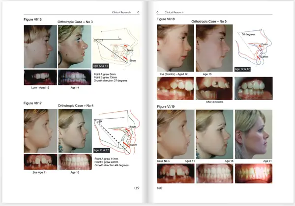 Interior spread — before and after cases